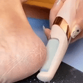 Electric Callus Remover - Soothe™